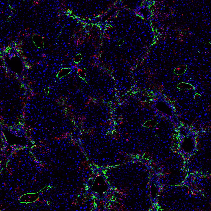 普通切片扫描(荧光双标)