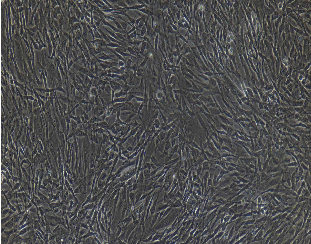 二型肺泡上皮细胞图片