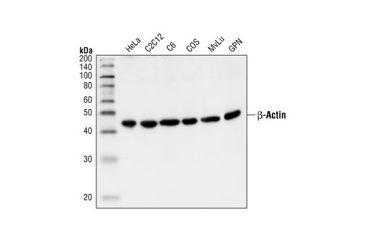 4967s β-actin antibody