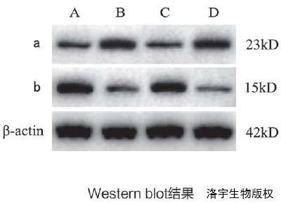 WB检测蛋白（剪膜）