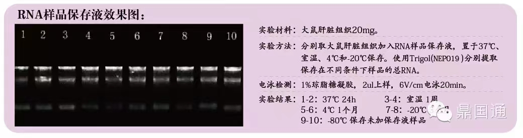 RNA样品保存液