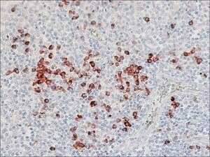 A5175-1ML，Anti-Human Lambda Light Chains (Bound and Free)−Peroxidase antibody produced in goat