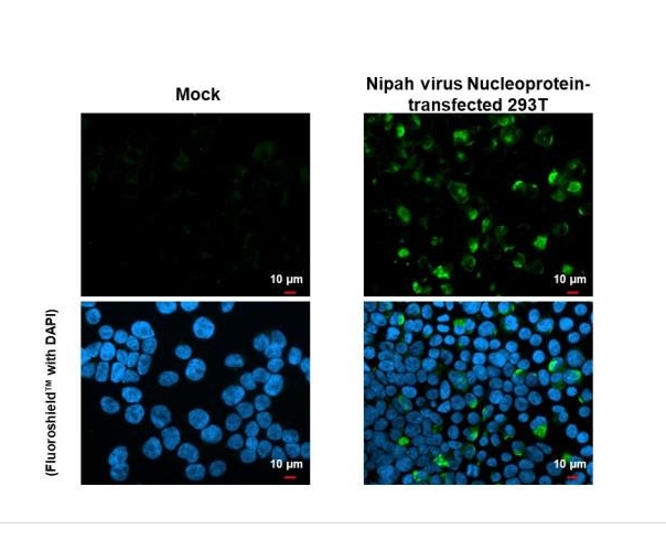 Nipah Virus Nucleoprotein Recombinant Rabbit Monoclonal Antibody (HL1436)