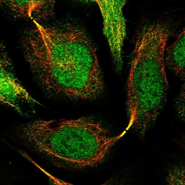 SNRNP25 Polyclonal Antibody