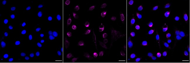 HOXA9 Recombinant Rabbit Monoclonal Antibody (23GB6645)
