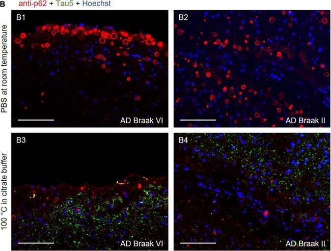 Goat anti-Mouse IgG2a Cross-Adsorbed Secondary Antibody, Alexa Fluor 555