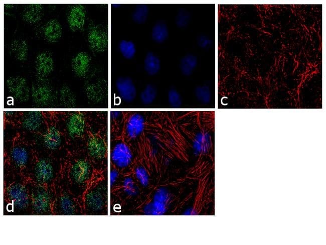 TBX5 Polyclonal Antibody