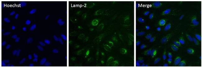 LAMP2 Monoclonal Antibody (H4B4)