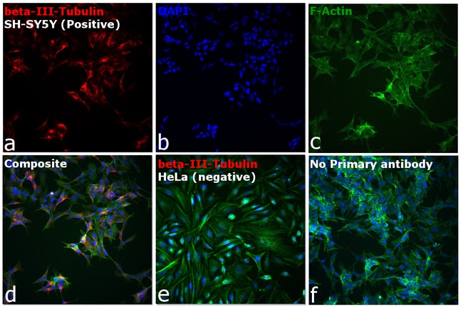 Goat anti-Mouse IgG2a Cross-Adsorbed Secondary Antibody, Alexa Fluor 594