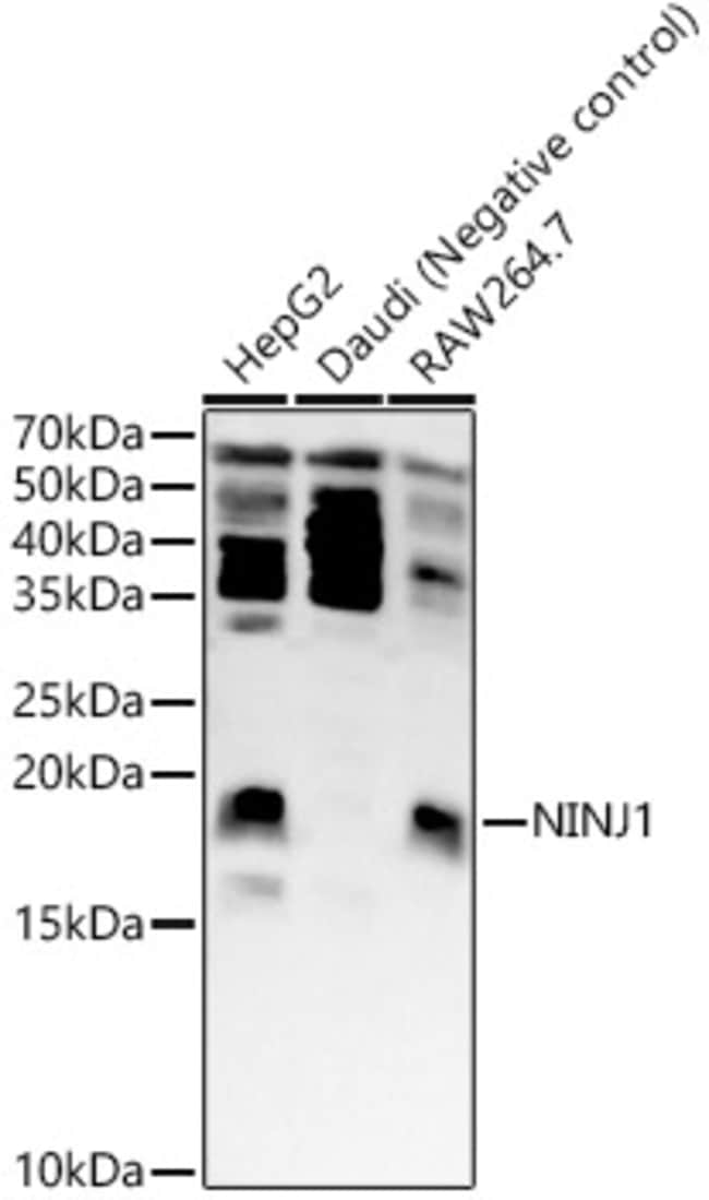 Ninjurin 1 Polyclonal Antibody
