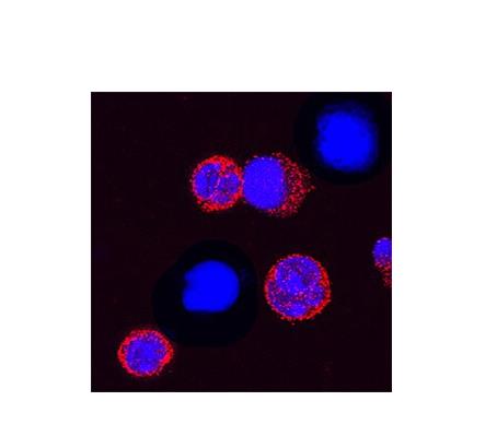 TREM1 Monoclonal Antibody (174031)