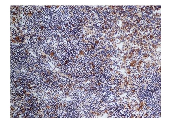 CD68 Monoclonal Antibody (FA-11)