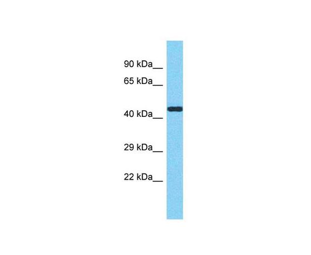 METTL17 Polyclonal Antibody