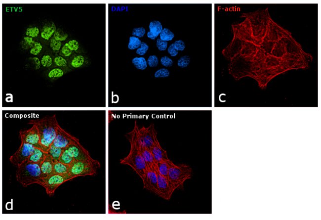 ETV5 Monoclonal Antibody (3H3)