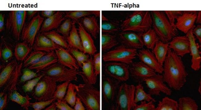 NFkB p65 Polyclonal Antibody