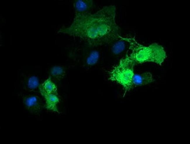 PARVA Monoclonal Antibody (OTI1C11)