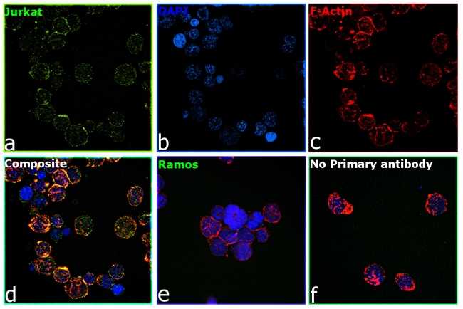 ULK1 Recombinant Rabbit Monoclonal Antibody (JA58-36)