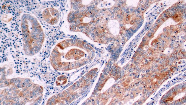 Bcl-2 Polyclonal Antibody