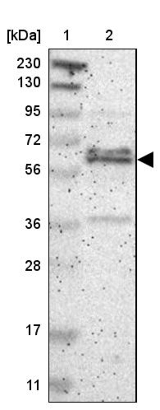 ZNF135 Polyclonal Antibody