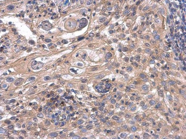 ACOX3 Polyclonal Antibody