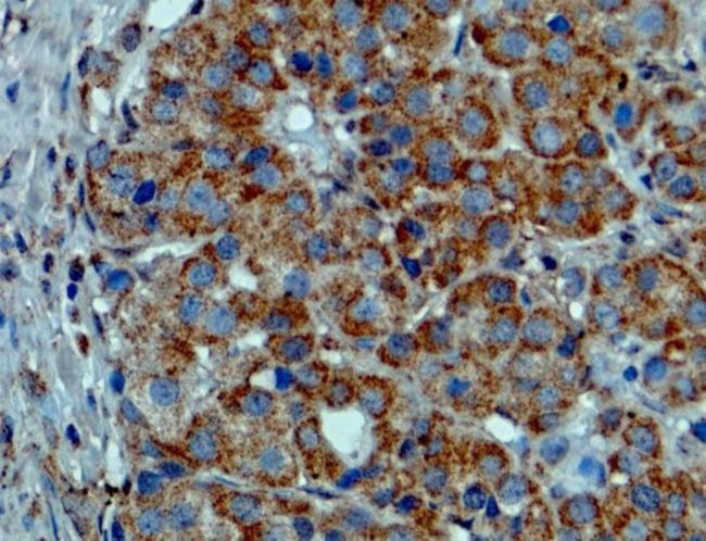 B-Raf (V600E) Recombinant Rabbit Monoclonal Antibody (RM8)