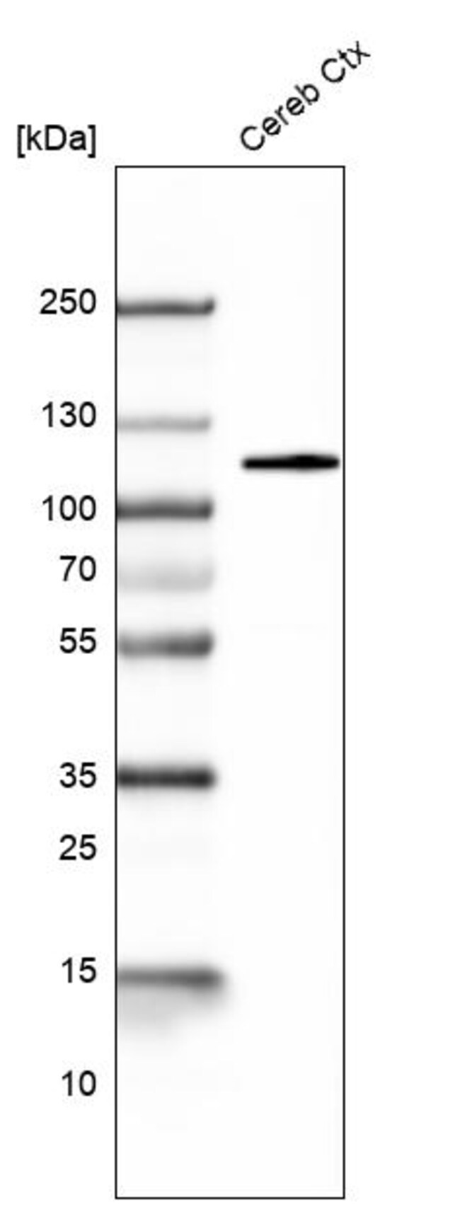 BCL11B Monoclonal Antibody (CL6426)