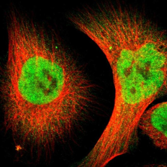 ZMYM3 Polyclonal Antibody