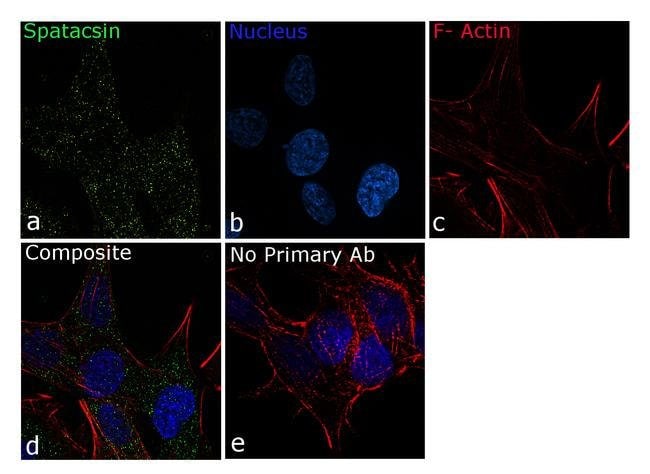 SPG11 Recombinant Rabbit Monoclonal Antibody (2H25L11)