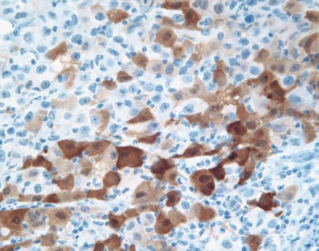 NY-ESO-1 Monoclonal Antibody (E978)