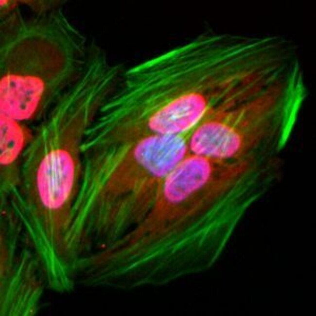 Acetylated Lysine Recombinant Rabbit Monoclonal Antibody (RM101)