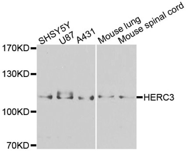 HERC3 Polyclonal Antibody