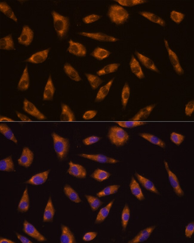 GLP1R Polyclonal Antibody