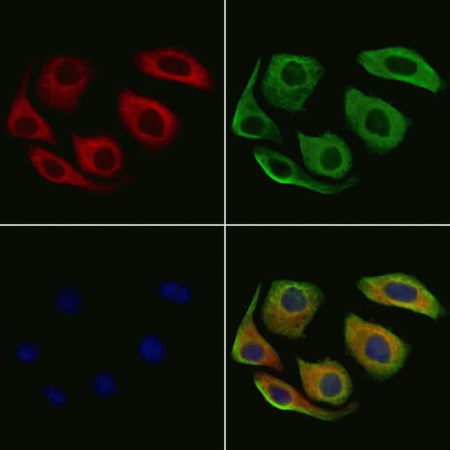ARHGEF6 Polyclonal Antibody