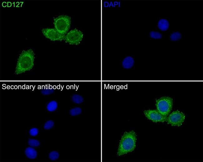 CD127 Recombinant Rabbit Monoclonal Antibody (JE37-10)