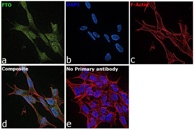 FTO Monoclonal Antibody (5-2H10)