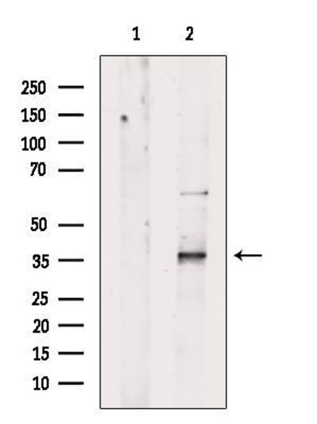 ZFP36L1 Polyclonal Antibody