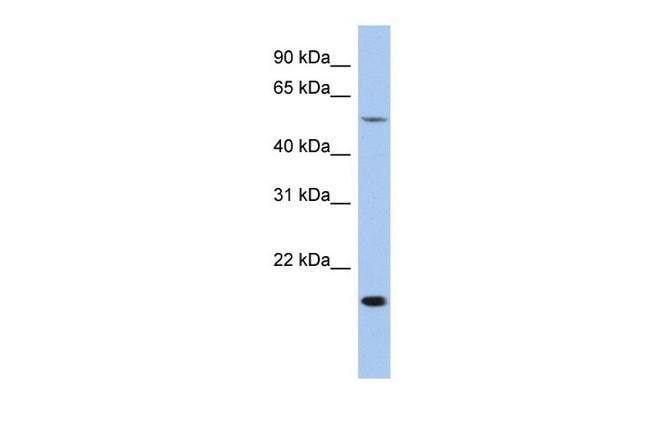 TEAD2 Polyclonal Antibody