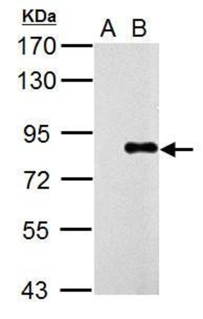 Influenza A PA Polyclonal Antibody