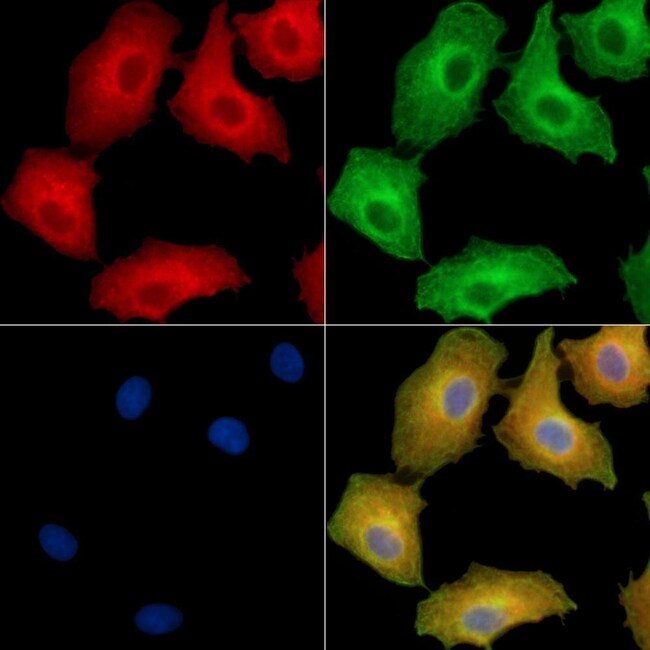 EDEM2 Polyclonal Antibody