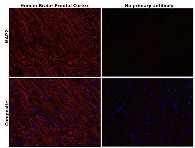 MAP2 Monoclonal Antibody (M13)