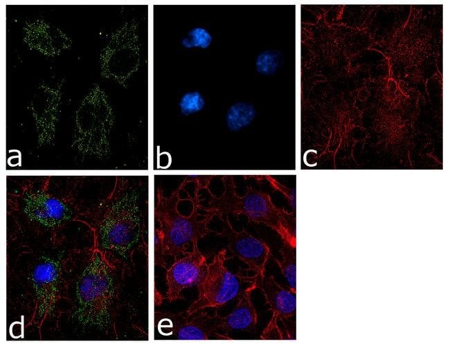 Ferritin Heavy Chain Recombinant Rabbit Monoclonal Antibody (9H17L10)