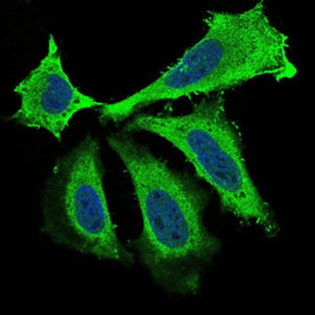 BDNF Monoclonal Antibody (3D9C5)