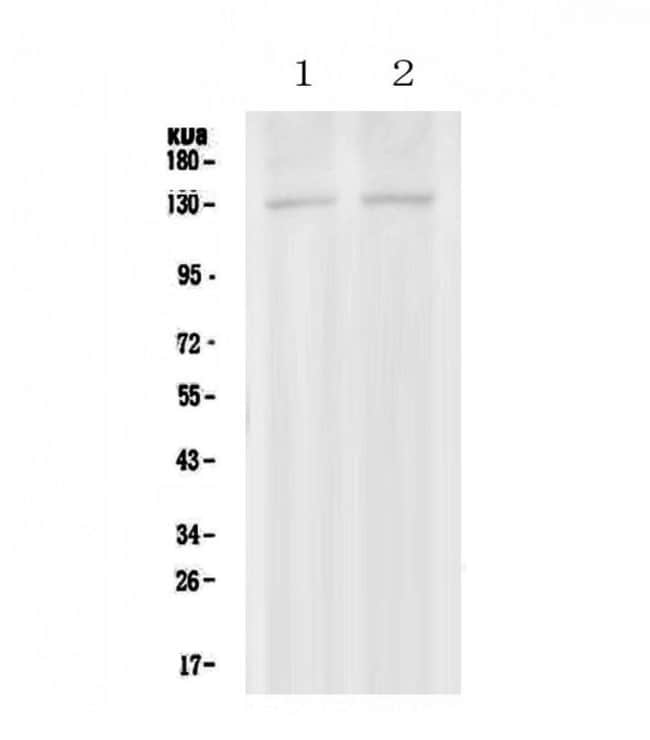 PSD Polyclonal Antibody