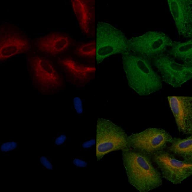 DRD2 Polyclonal Antibody