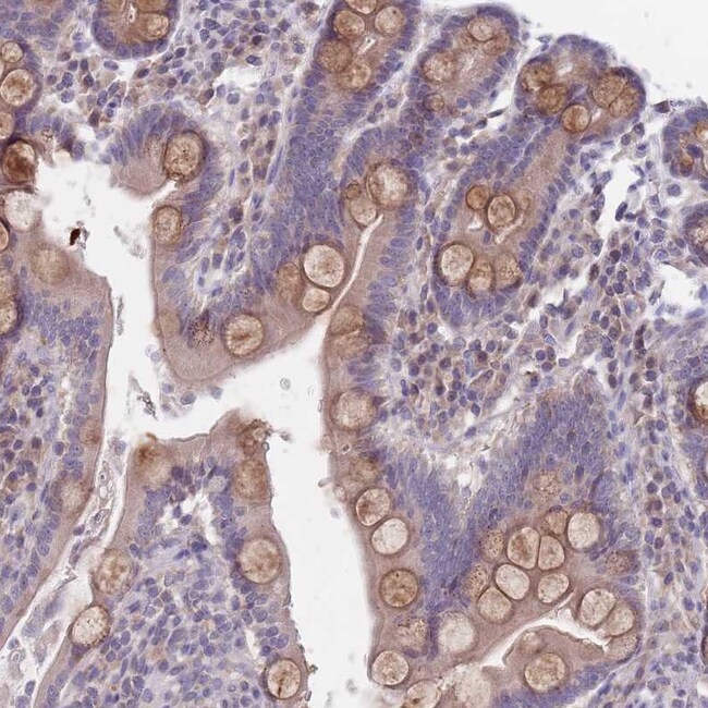FTSJD1 Polyclonal Antibody
