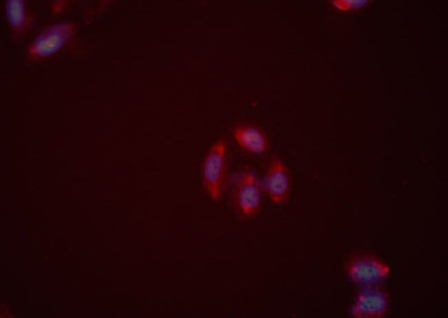 NPY2R Polyclonal Antibody