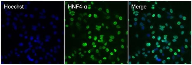 HNF4A Monoclonal Antibody (K9218)