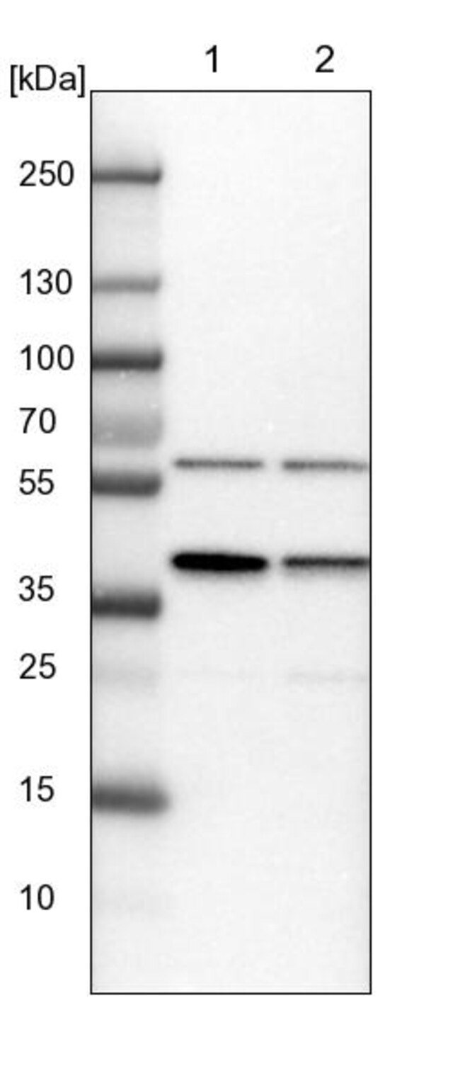 PRPF18 Polyclonal Antibody