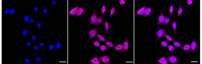 Endothelin B Receptor Recombinant Rabbit Monoclonal Antibody (24GB3375)
