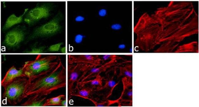 GAPDH Monoclonal Antibody (6C5)